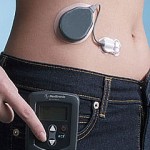 pancreas_artificial