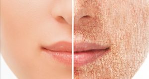 ¿Cómo cuidar nuestra piel según la edad?