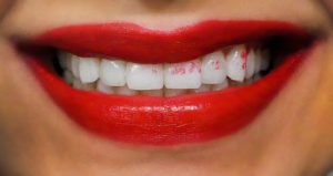 Como evitar que tus dientes se manchen con labial