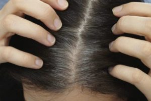 Canas prematuras ¿A qué se debe?