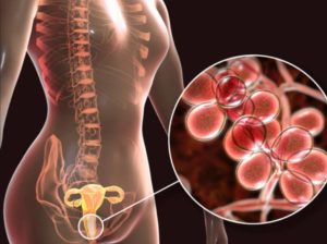 14 de marzo, Día Mundial de la Endometriosis