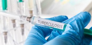 La OMS alerta: por primera vez en más de una década aumenta la tuberculosis