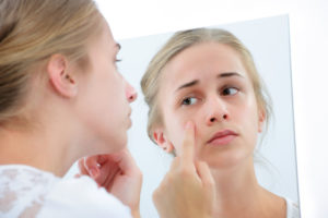 Acné en la adolescencia: guía completa para combatir las imperfecciones